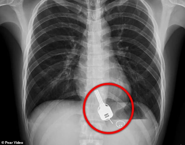 Xray Ngx
