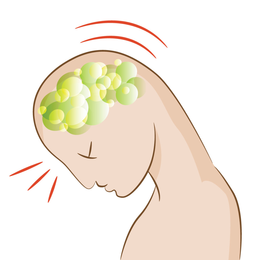 Marin concussions