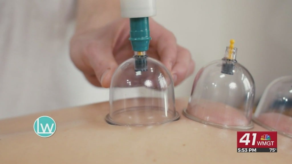 Living Well With Troy Thompson: Cupping Therapy