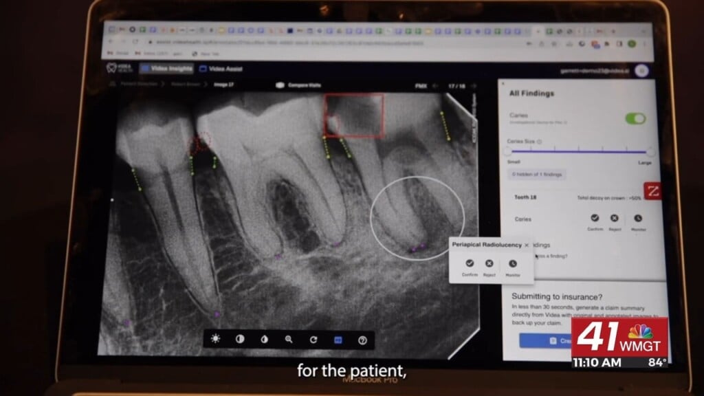 Tech Report: Ai Is Helping Dentists Catch Problems Early