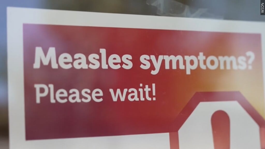 Measles
