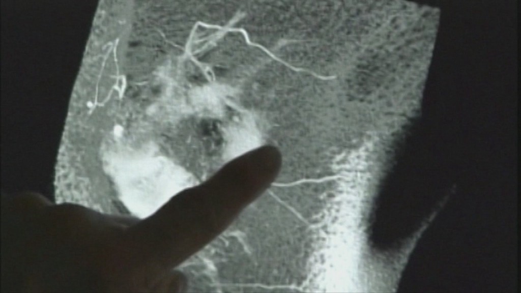 Mammograms & Covid 19 Pkg