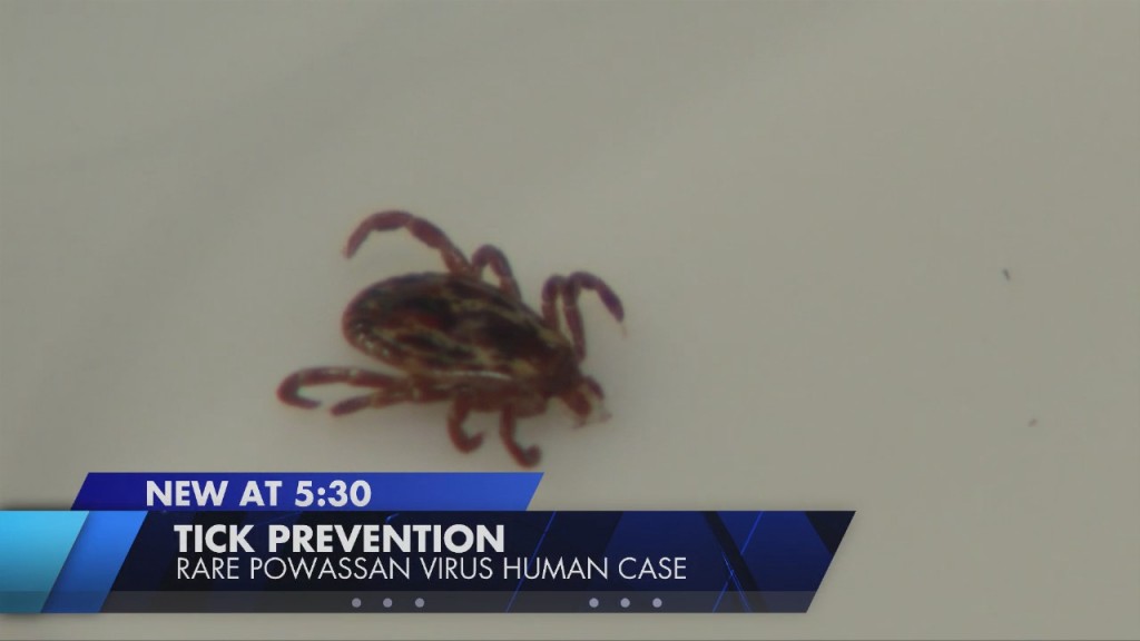Rare Human Case Of Powassan Virus Serves As Reminder To Prevent Tick Exposure
