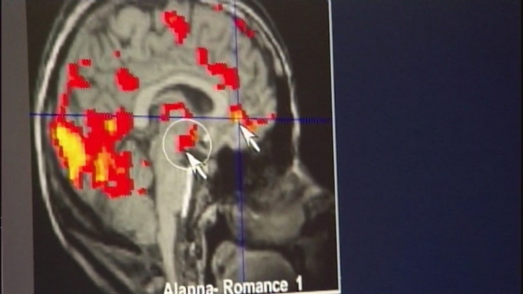 Alarming Alzheimer's Statistics