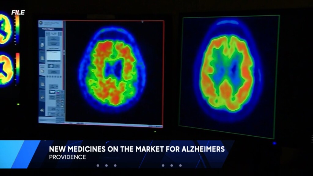 Butler Alzheimers Research