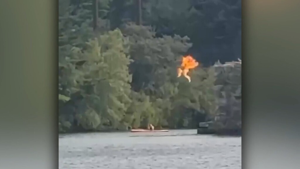 Rhode Island State Fire Marshal Warns Residents Of Tiktok Trend After Teen Suffers Serious Burns