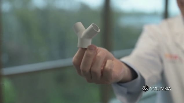 Ventilator Prototype