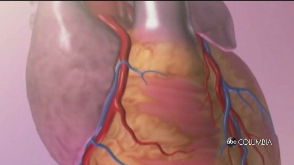Heart Health
