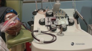 Plasma Donation