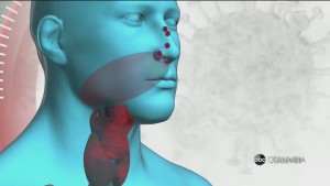 Half Masking Dangers