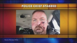 Chief Police Stabbed
