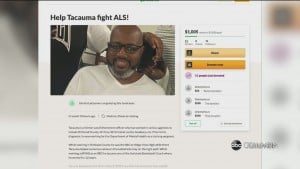 Tacauma Als