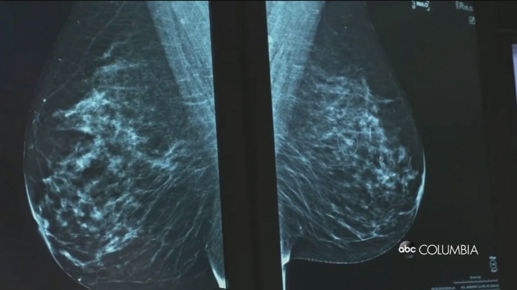 Vax And Mammogram
