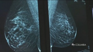 Vax And Mammogram