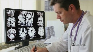 Keto Diet Brain Tumor Study