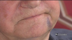 Marion Cemetary Attack