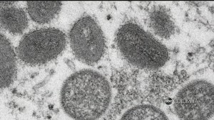 Cdc Monkeypox