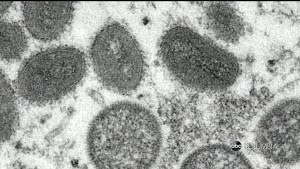 Sc Monkeypox Alex Pkg