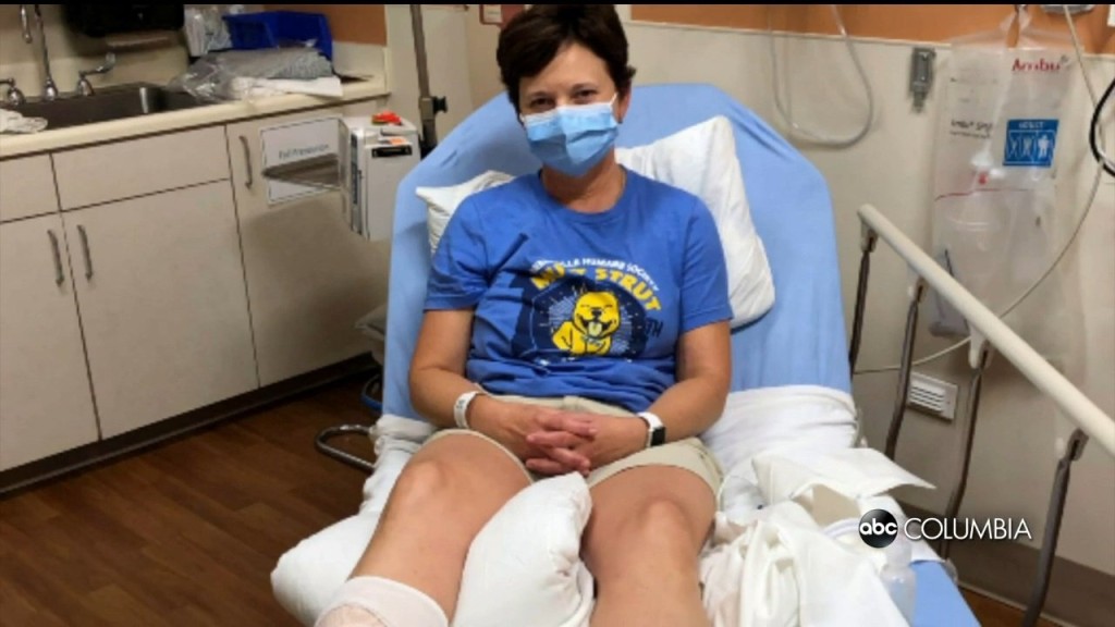 Greenville Woman Recovering After Raccoon Attack On Hilton Head Island