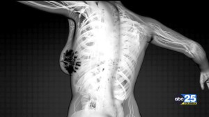 Midlands Cares Breast Cancer