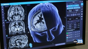 Alz Tests