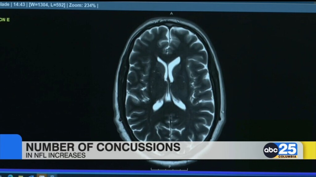 Number Of Concussions In Nfl Increases