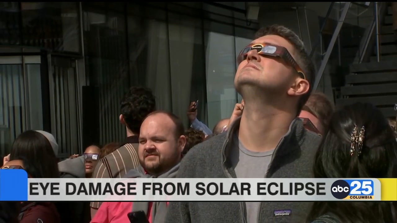 Solar eclipse eye damage - ABC Columbia