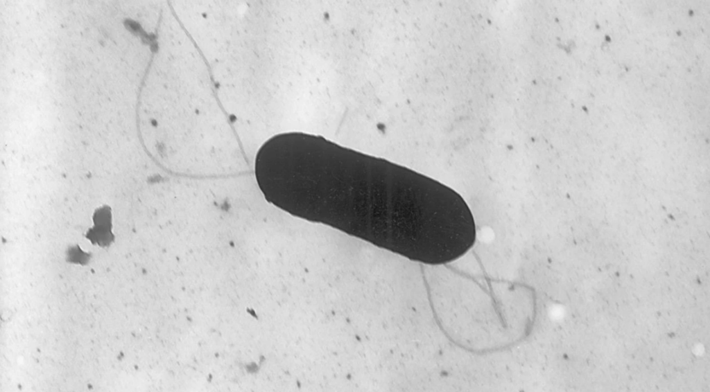 Listeria monocytogenes bacterium