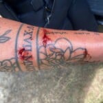 Rcsd Dog Bite
