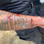 Rcsd Dog Bite 3