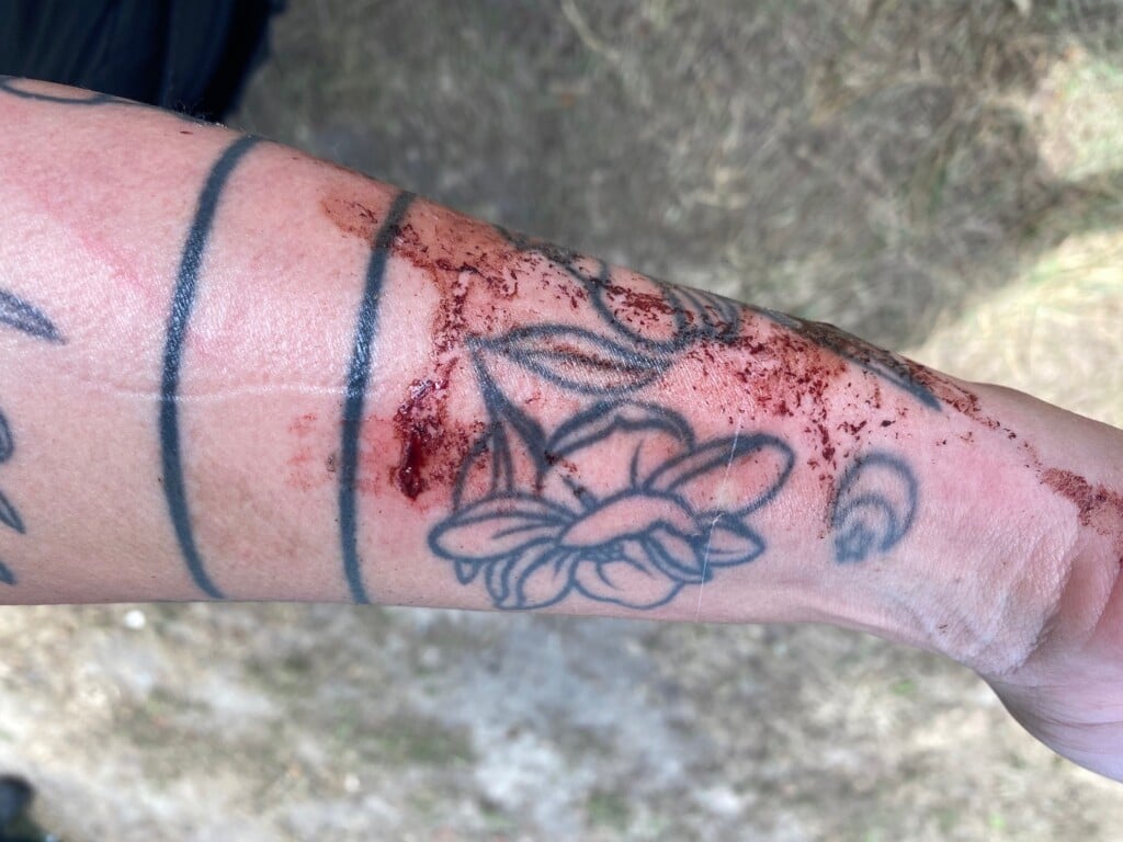 Rcsd Dog Bite 2