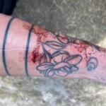 Rcsd Dog Bite 2