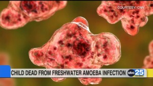 Extremely Rare But Almost Always Fatal Midlands Child Dies From Freshwater Amoeba Infection