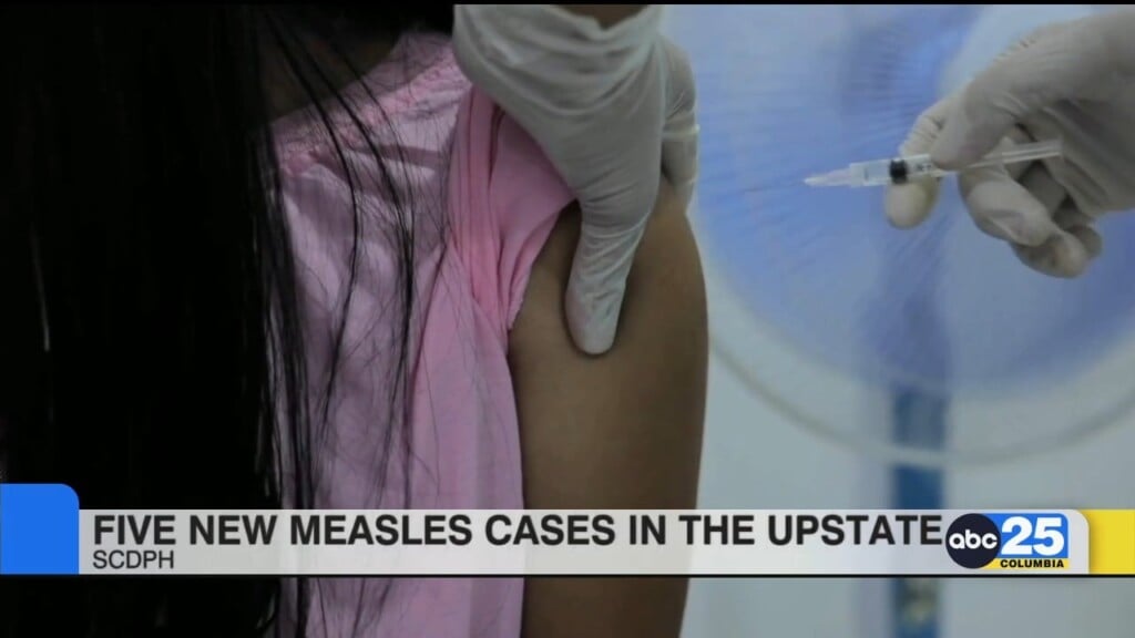 5 New Measles Cases In The Upstate
