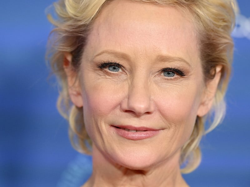 Anne Heche Is In ‘stable Condition’ Following Car Crash
