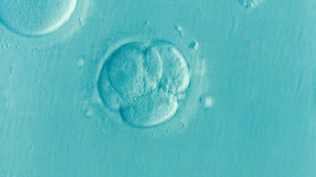 Human Embryo