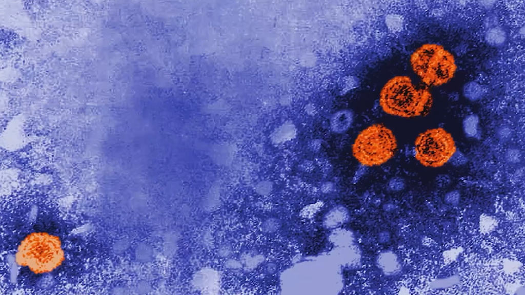 Severe Cases Of Hepatitis Among Children