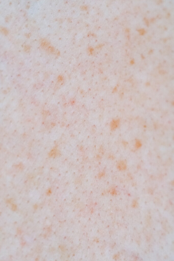 Skin (Source: Pexels/Angela Roma)