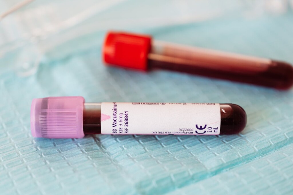 blood vial (Source: Pexels/Karolina Grabowska)