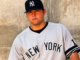 Joba Chamberlain No Longer Looks Like a Dog