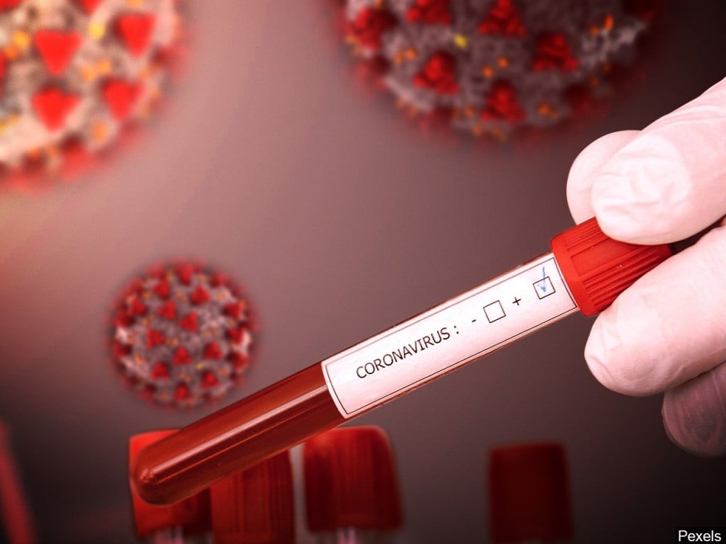 coronavirus tests