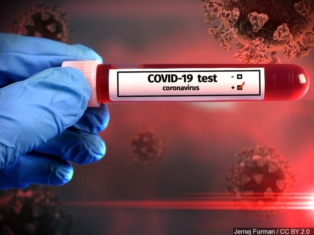 Bryan Health Coronavirus Update