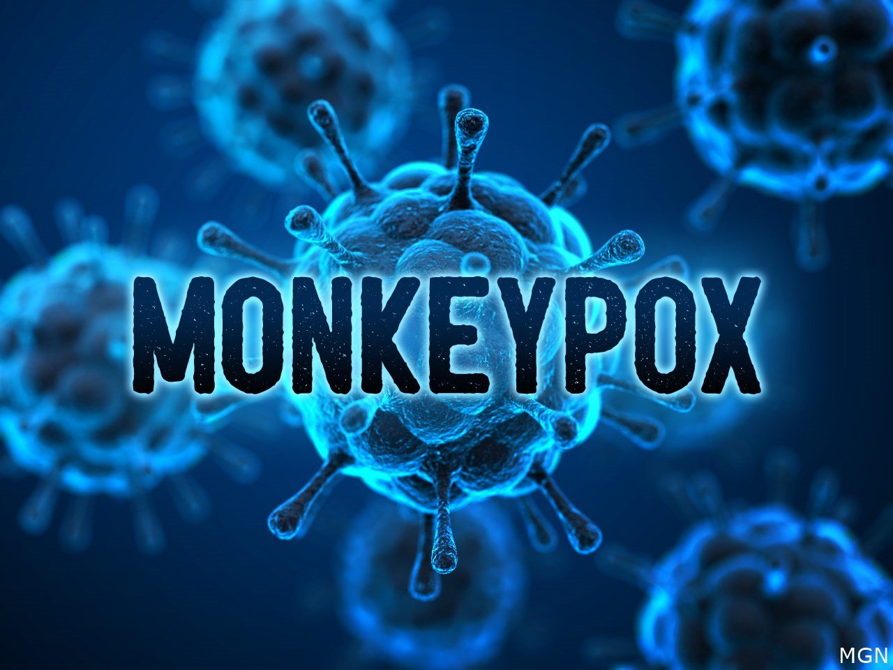 Monkeypox is a new global threat. African scientists know what the world is  up against, Science