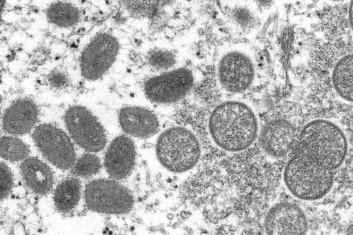 Massachusetts Health Officials Confirm Additional Case Of Monkeypox
