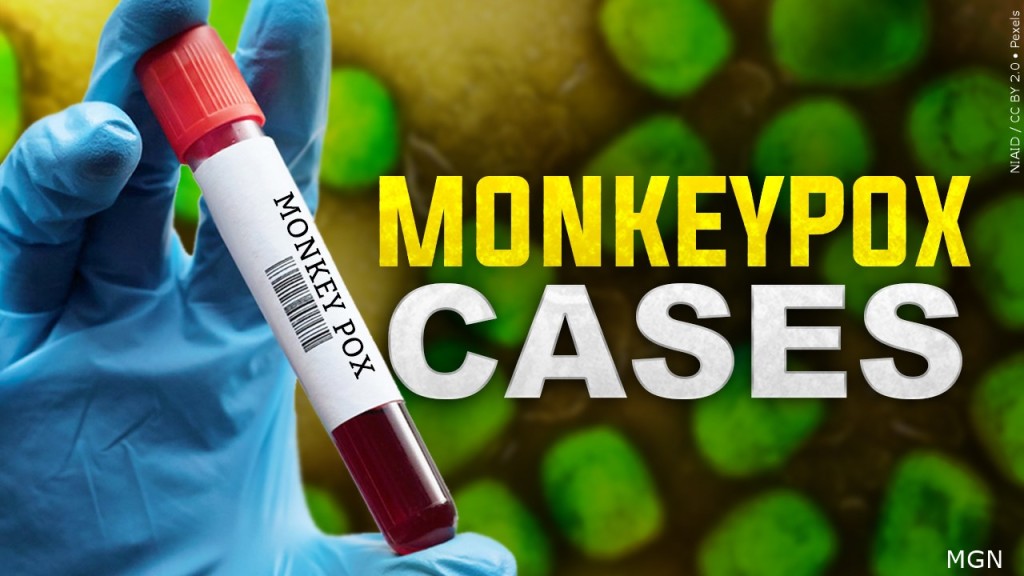 Sarpy County reports first case of monkeypox