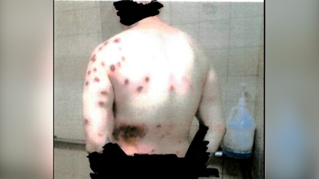 Inmate wounds after around 200 non-lethal rounds were shot.