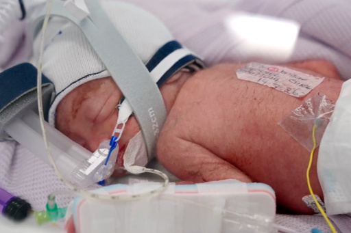 An Australian Woman Gives Birth To Rare Identical Quadruplet Girls