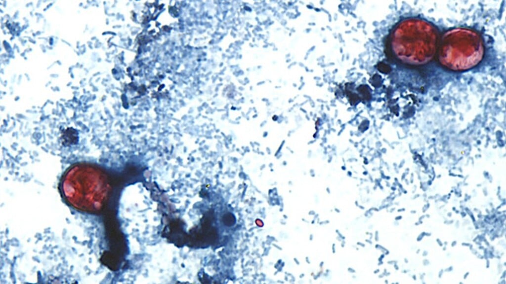 Cyclospora parasite