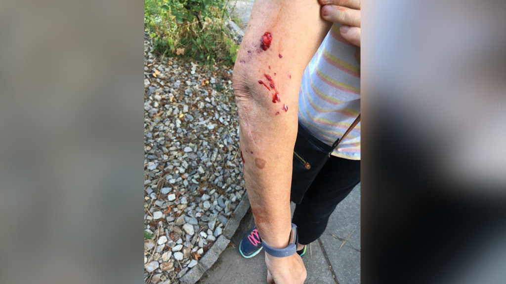 Spokane grandmother attacked by dogs in her own backyard