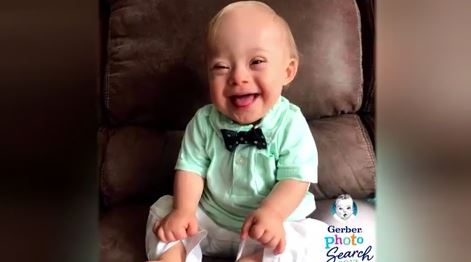 This year’s Gerber baby is the first with Down syndrome